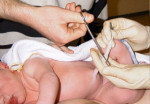 Toxic substances in umbilical cord blood of Canadian newborns